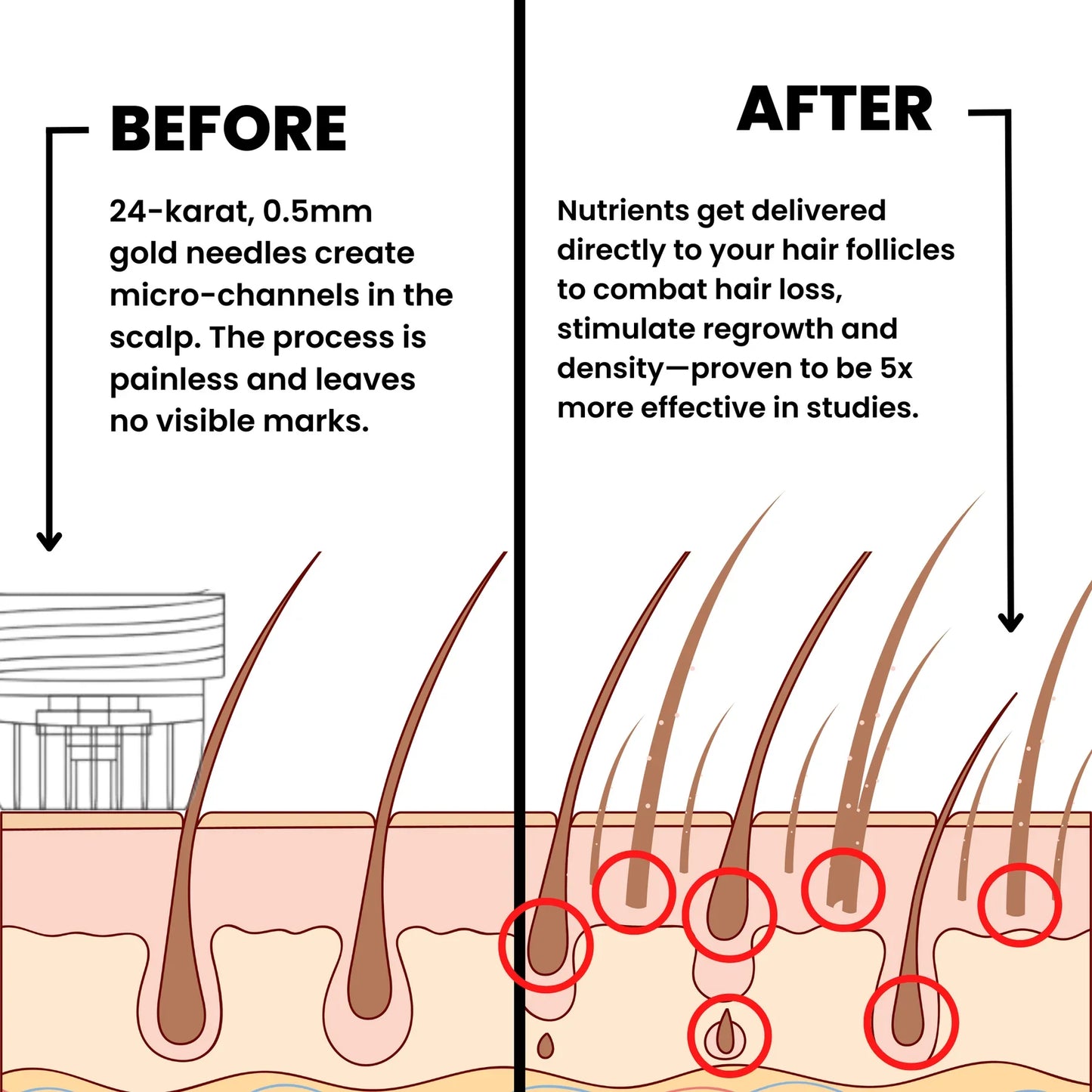 Hair Regrowth System