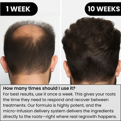 Hair Regrowth System